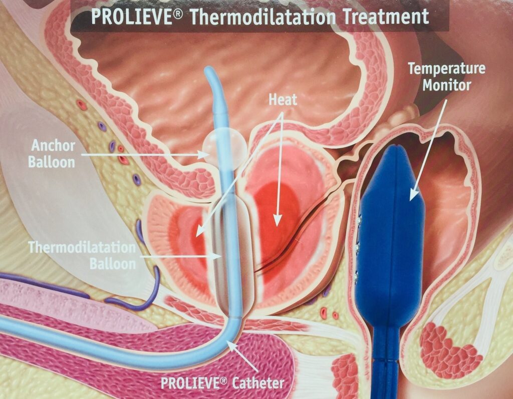 Erectile Dysfunction