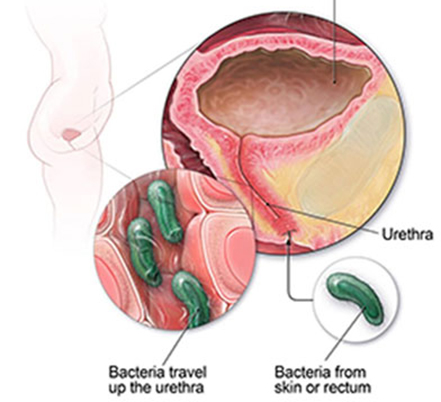 Urinary Tract