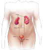  Urinary Tract Infection  